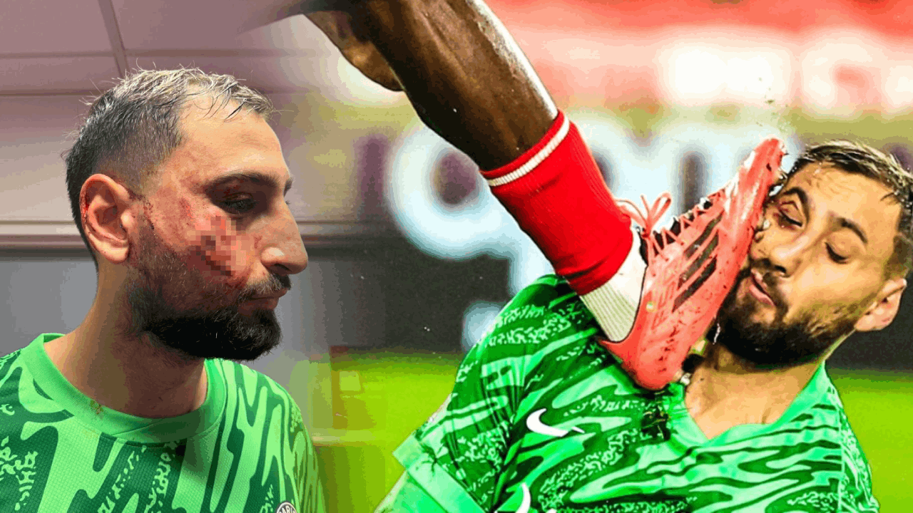 Donnarumma'nın Korkutucu Sakatlığı: PSG'nin Yıldız Kalecisi Yüzünden Yaralandı! Hakem Kartına Dahi İhtiyaç Duymadı!